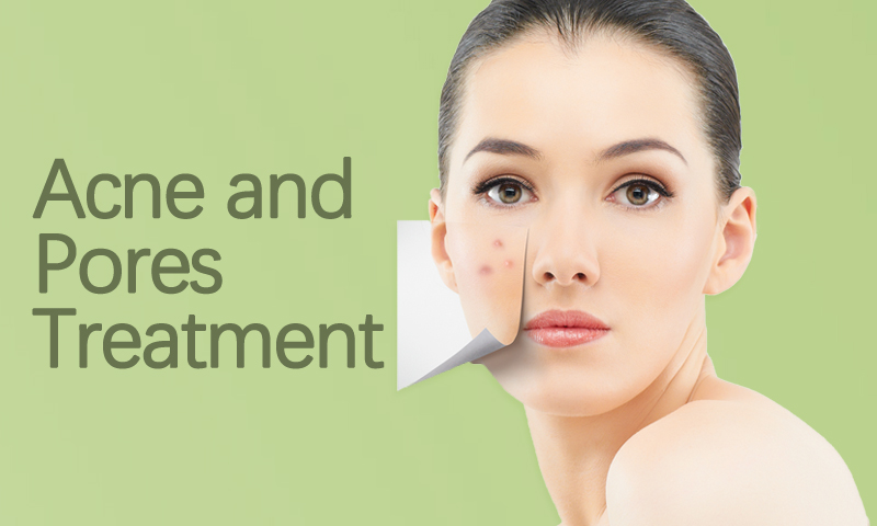 Acne and Pores treatment in Surat, Gujarat (India)