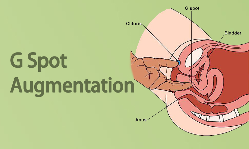 G Spot Augmentation in Surat, Gujarat (India)