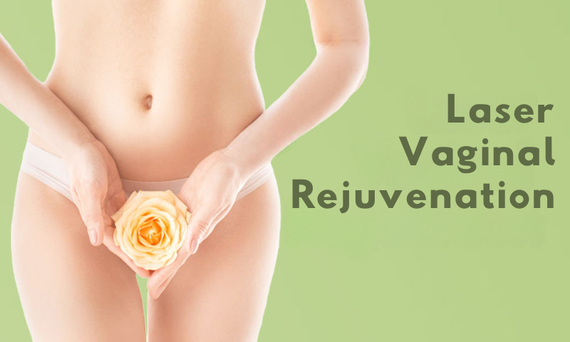 Laser Vaginal Rejuvenation