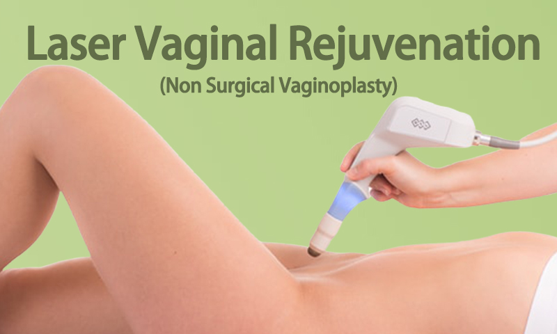 Laser Vaginal Rejuvenation (Non Surgical Vaginoplasty) in Surat, Gujarat (India)