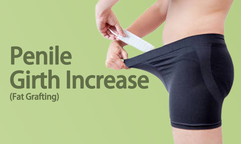 Penile Girth Increase (Fat Grafting) in Surat (Gujarat) India