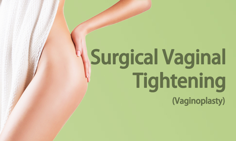 Surgical Vaginal Tightening (Vaginoplasty) in Surat, Gujarat (India)