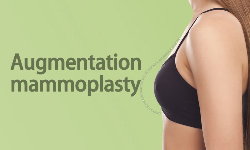 Augmentation Mammoplasty in Surat, Gujarat (India)
