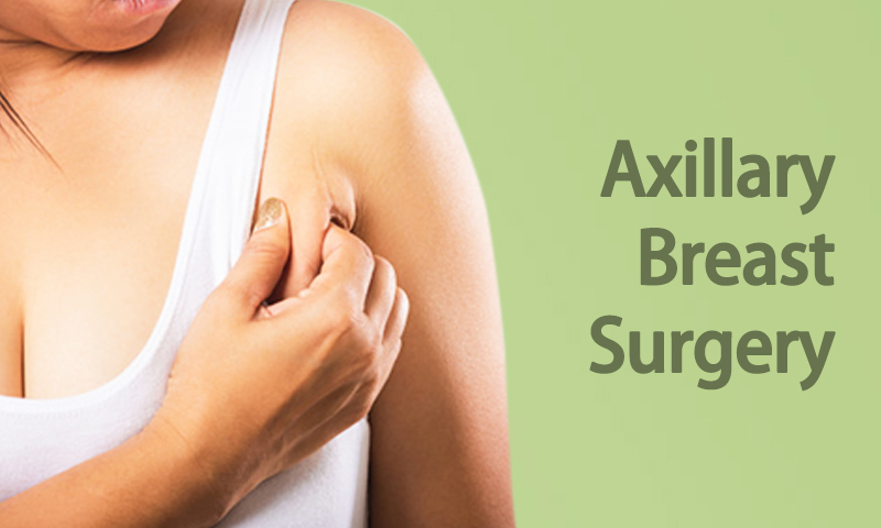 Axillary Breast Surgery in Surat, Gujarat (India)