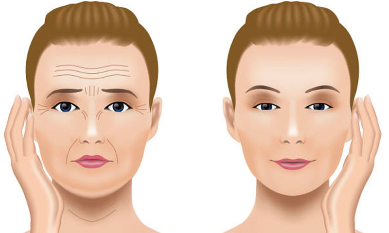Frown Lines Fillers Treatment in Surat, Gujarat (India)