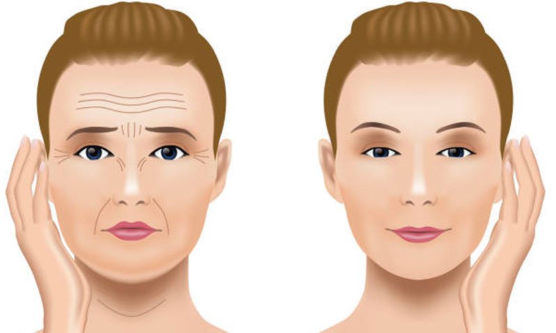 Preorbital Botox Treatment in Surat, Gujarat (India)