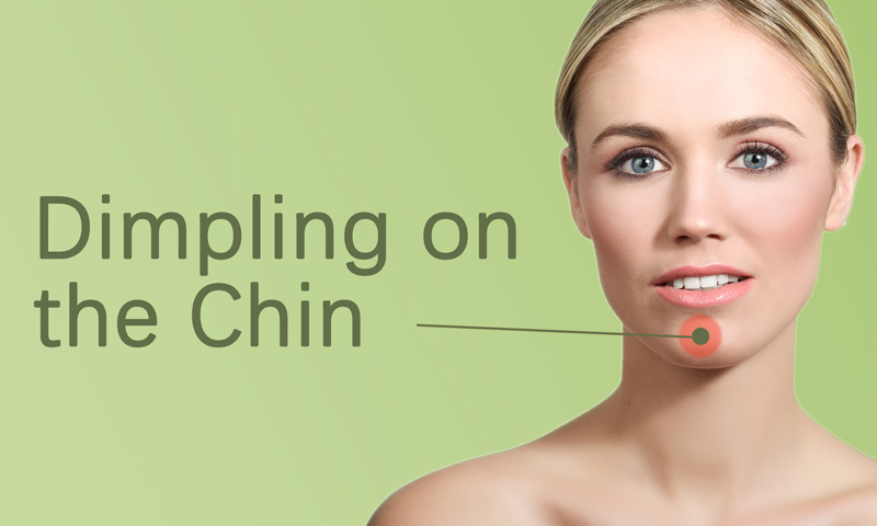 Dimpling on the Chin Treatment in Surat, Gujarat (India)