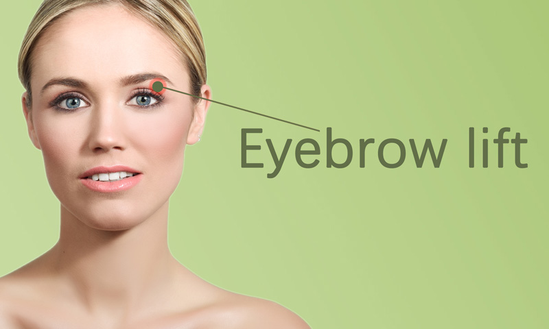 Eyebrow Lift Fillers Treatment in Surat, Gujarat (India)