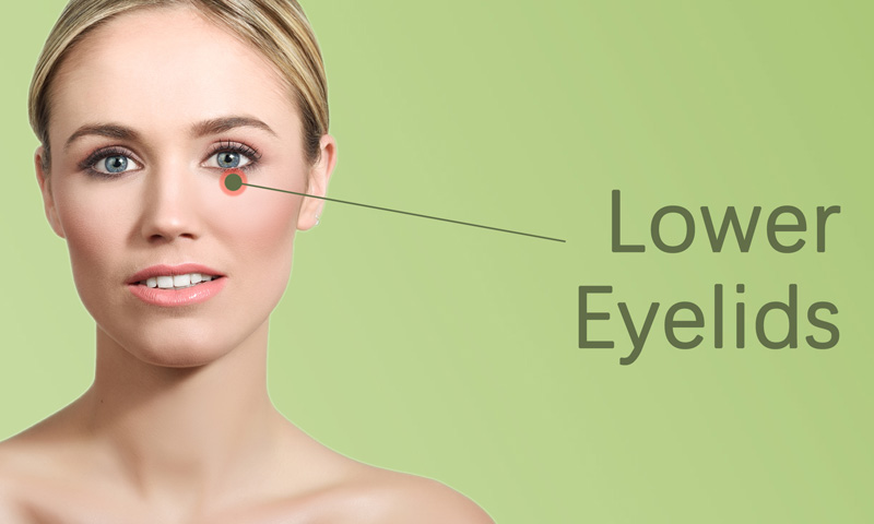 Lower Eyelids Botox Treatment in Surat, Gujarat (India)