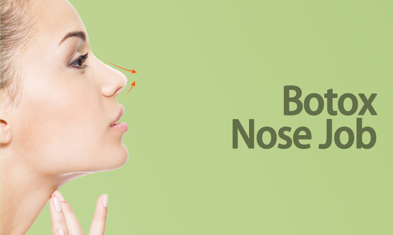 Botox Nose Job