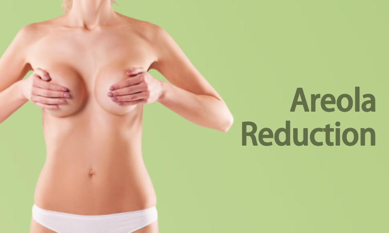 Areola Reduction Breast Surgery in Surat, Gujarat (India)