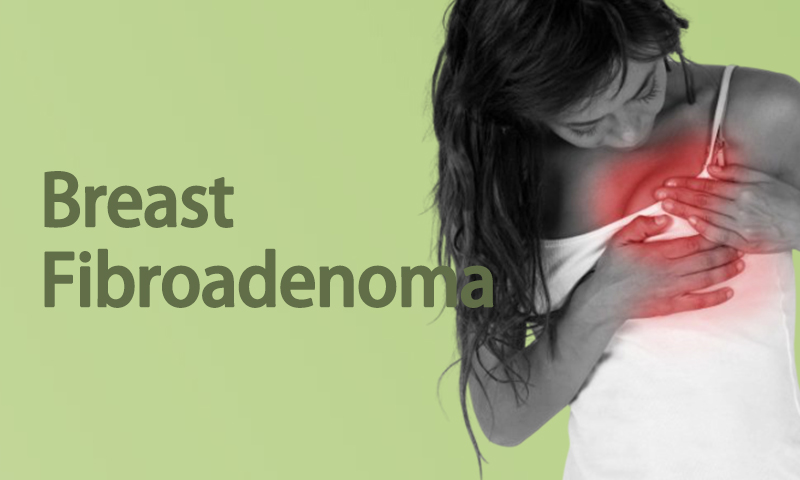 Breast Fibroadenoma Treatment in Surat, Gujarat (India)