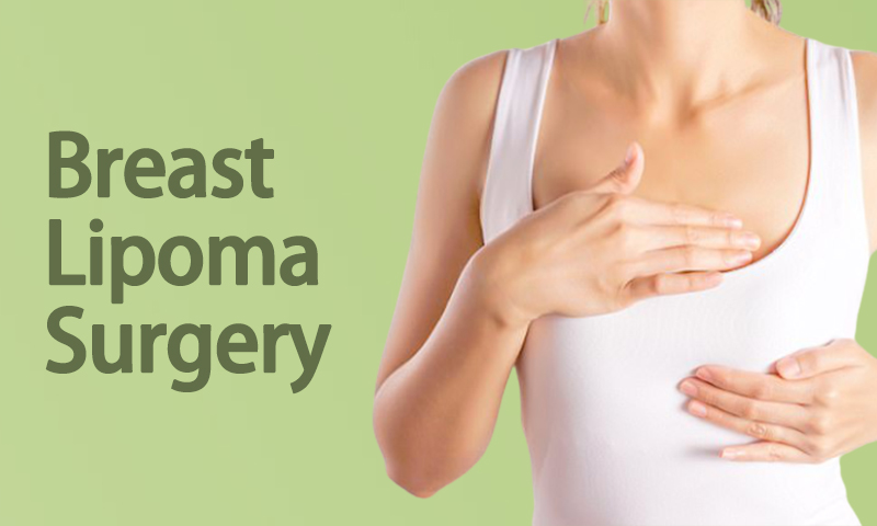 Breast Lipoma Surgery in Surat, Gujarat (India)