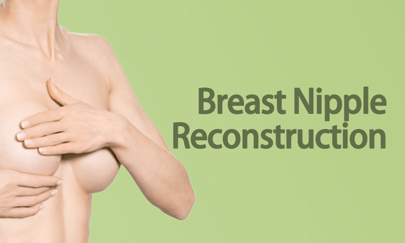 Breast Nipple Reconstruction Surgery in Surat, Gujarat (India)