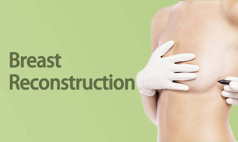 Breast Reconstruction Surgery in Surat, Gujarat (India)