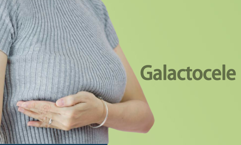 Galactocele Surgery in Surat, Gujarat (India)