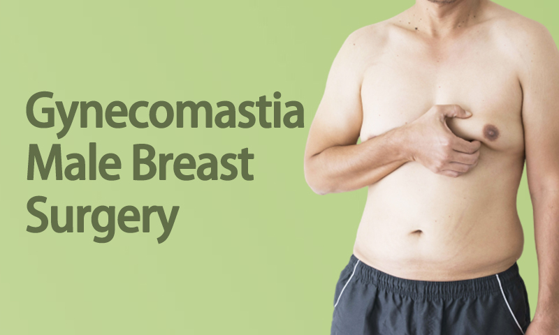 Gynecomastia – Male Breast Surgery in Surat, Gujarat (India)