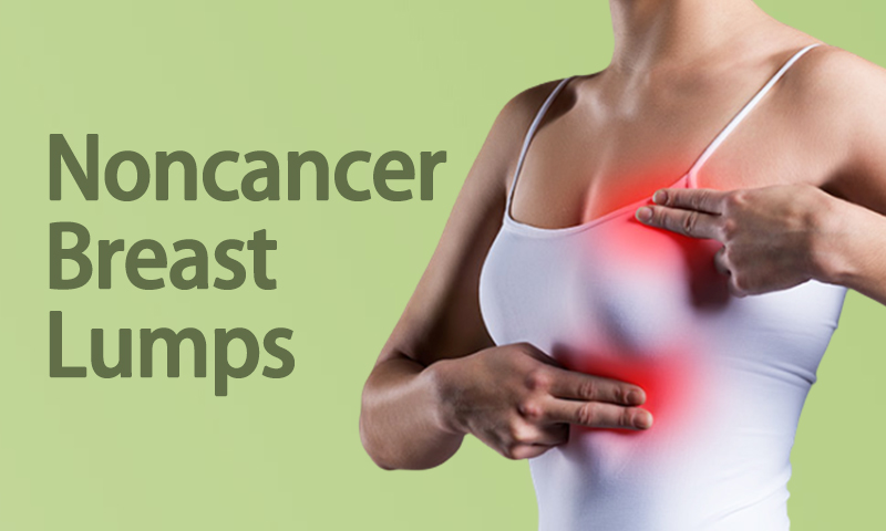 Non Cancer Breast Lumps Treatment in Surat, Gujarat (India)