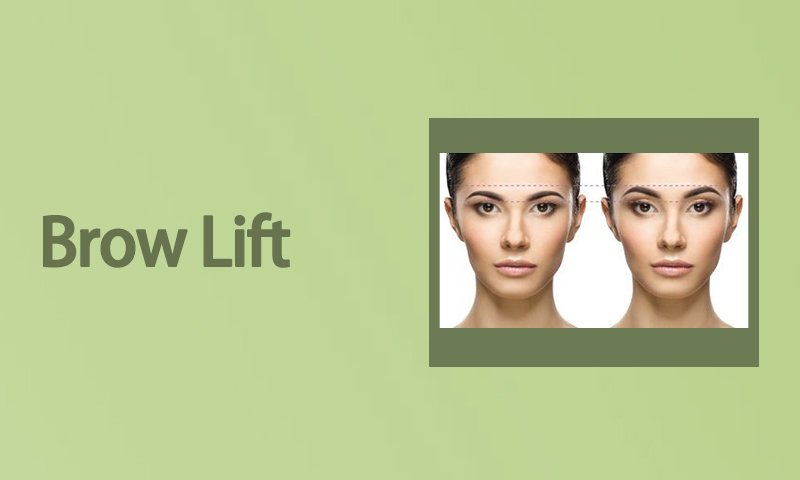 Brow Lift  in Surat, Gujarat (India)