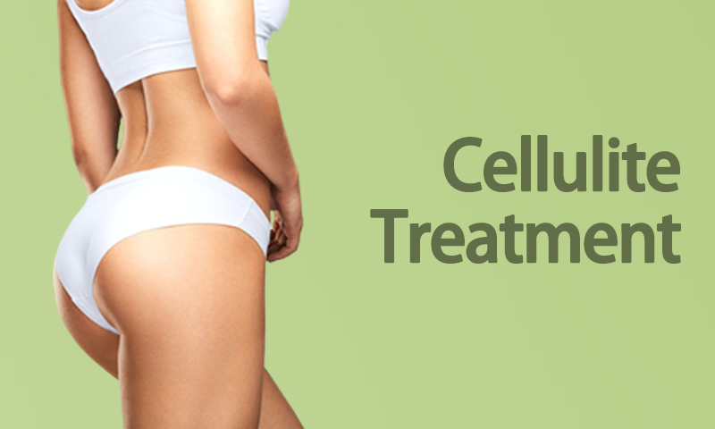 Cellulite Treatment