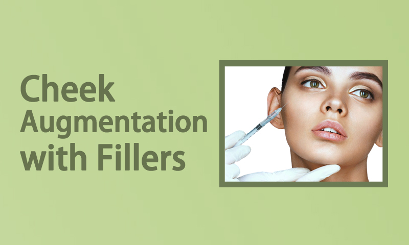 Cheek Augmentation with Fillers in Surat, Gujarat (India)