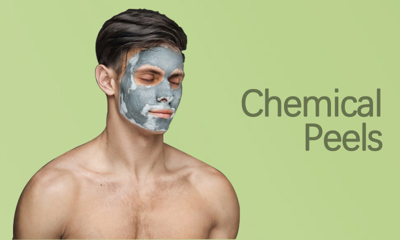 Chemical Peels Treatment in Surat, Gujarat (India)