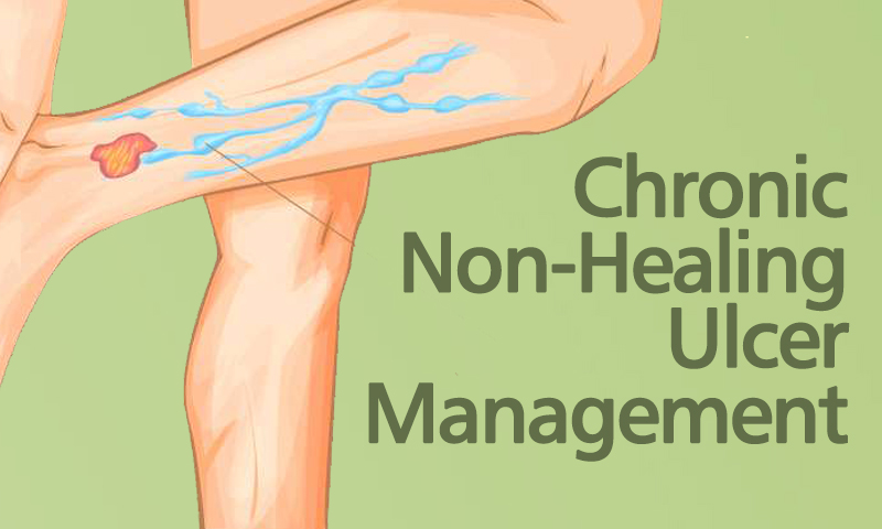 Chronic Non-Heling Ulcer Management