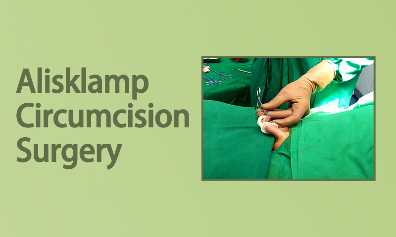 Alisklamp Circumcision Surgery