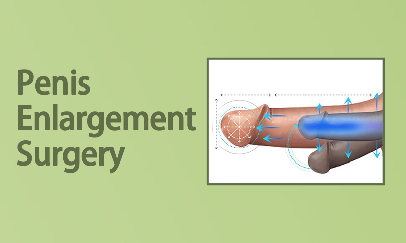 Penis Enlargement Surgery