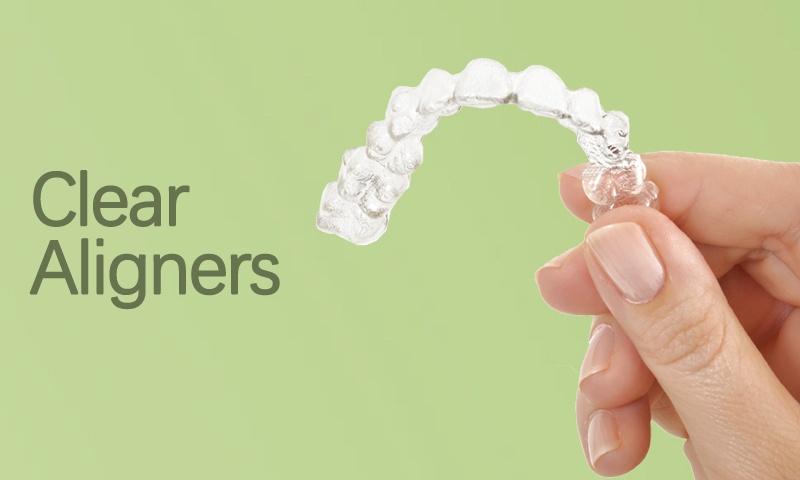 Clear Aligners in Surat, Gujarat (India)