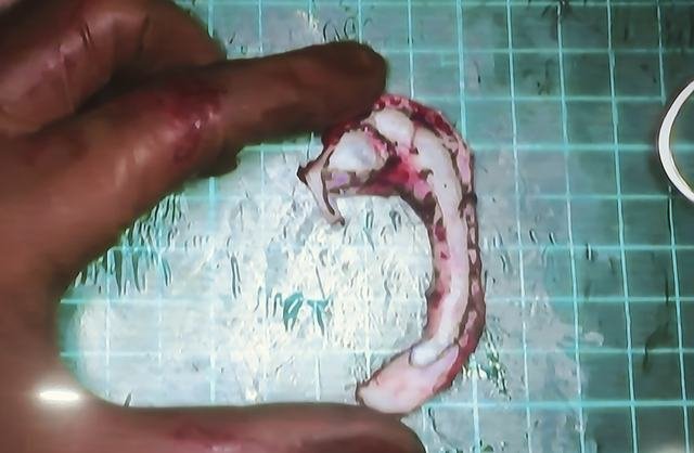 Dr. Ashutosh Shah at Ear reconstruction workshop, Bhubaneswar (Feb 2025), photo 5