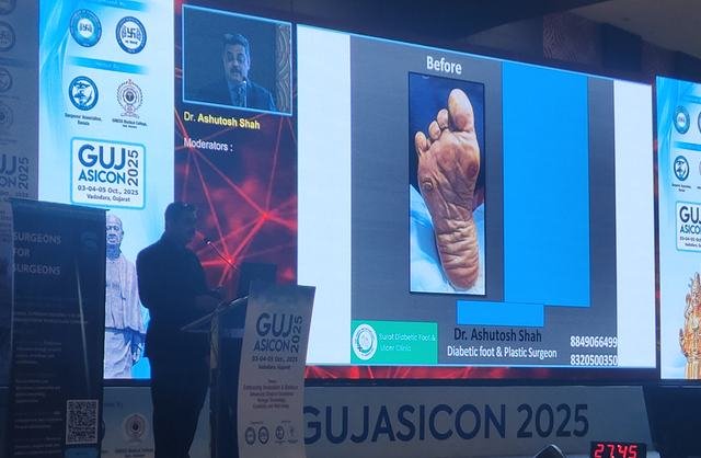 Dr. Ashutosh Shah at GUJASICON 2025, Vadodara (Oct 2025), photo 3