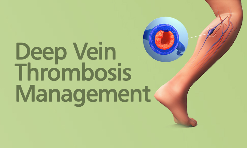 Deep Vein Thrombosis Management