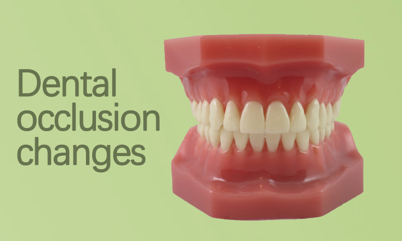 Dental Occlusion Treatment in Surat, Gujarat (India)