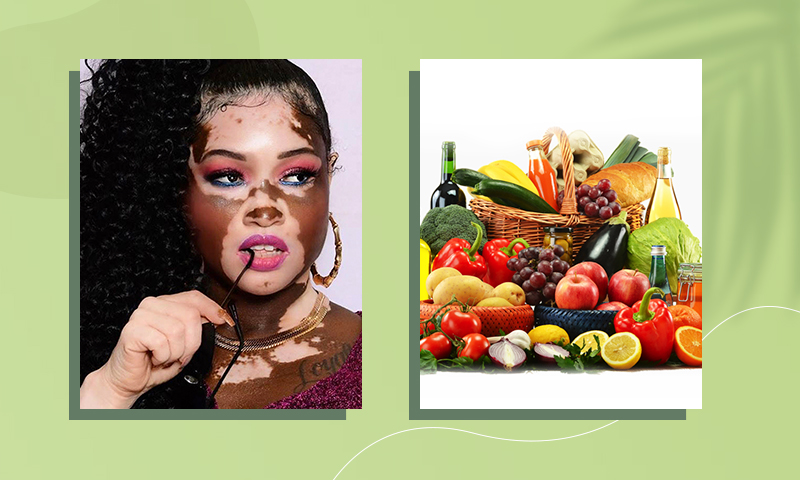 Diet For Vitiligo