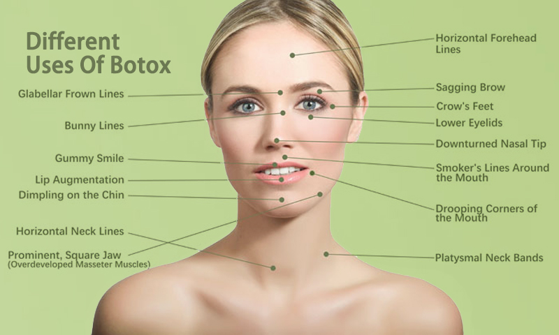 Different Uses Of Botox