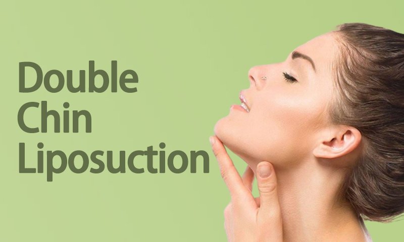 Double Chin Liposuction