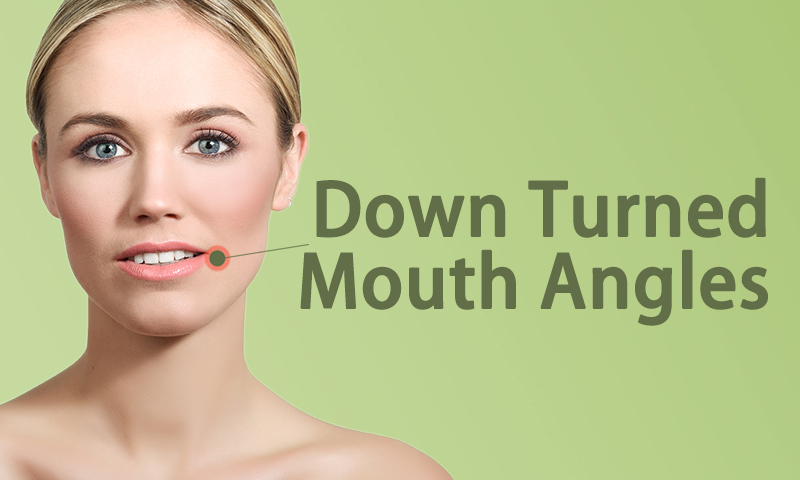 Down Turned Mouth Angles