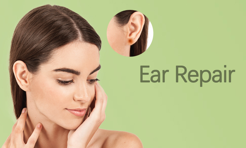 Ear Repair