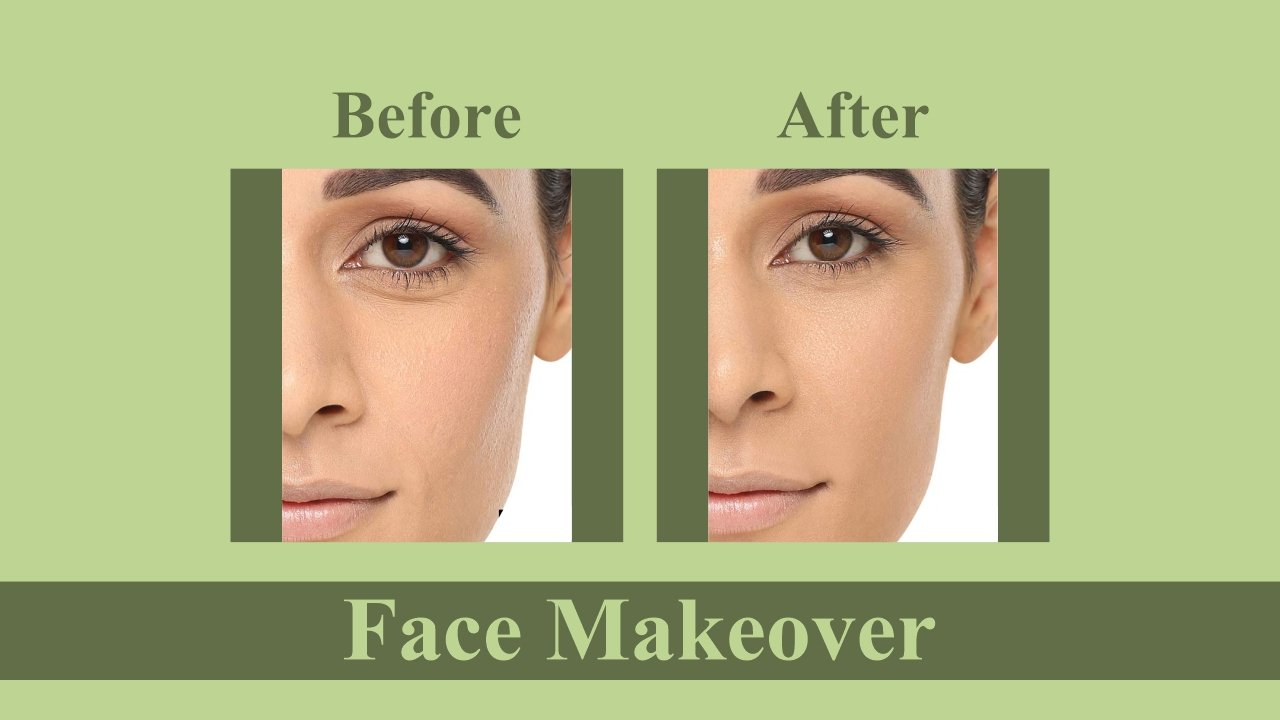 Mesotherapy For Face in Surat, Gujarat (India)