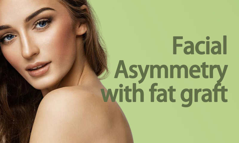 Facial Asymmetry With Fat Graft