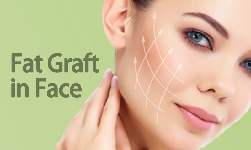 Fat Graft In Face