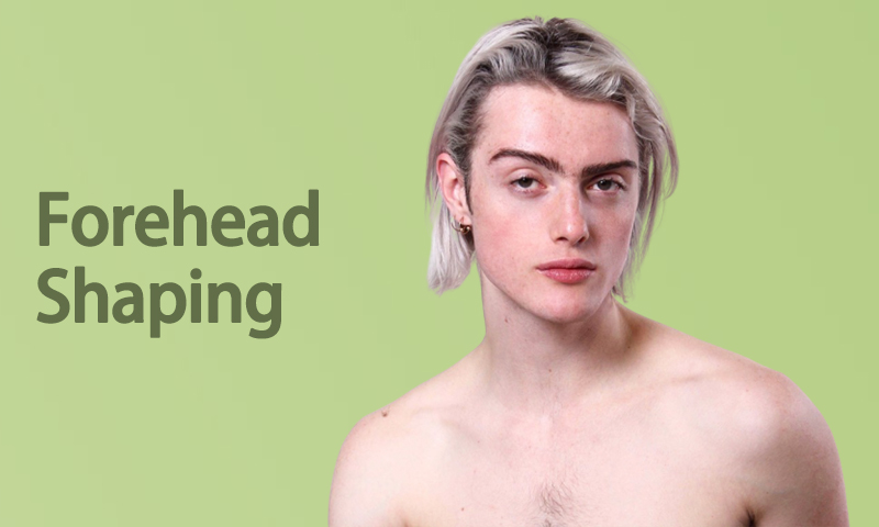 Forehead Shaping