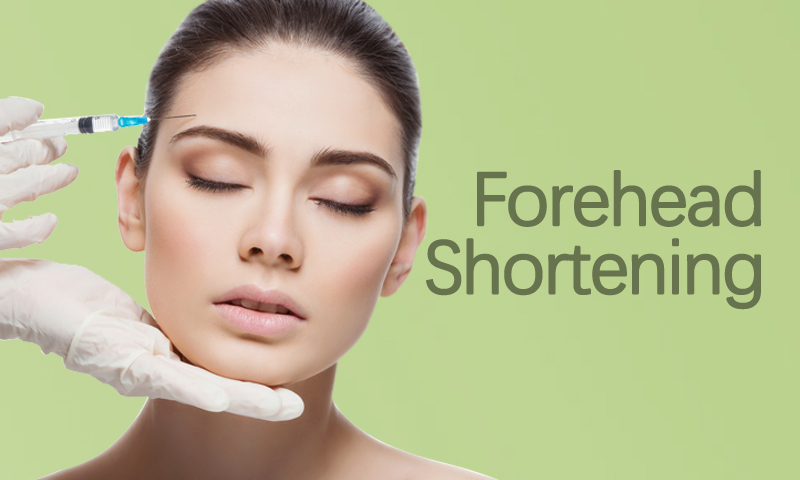 Forehead Shortening Surgery in Surat, Gujarat (India)