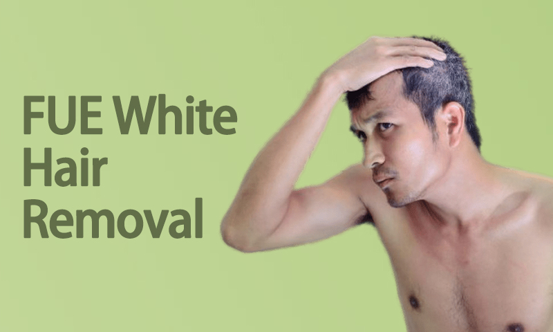 FUE White Hair Removal