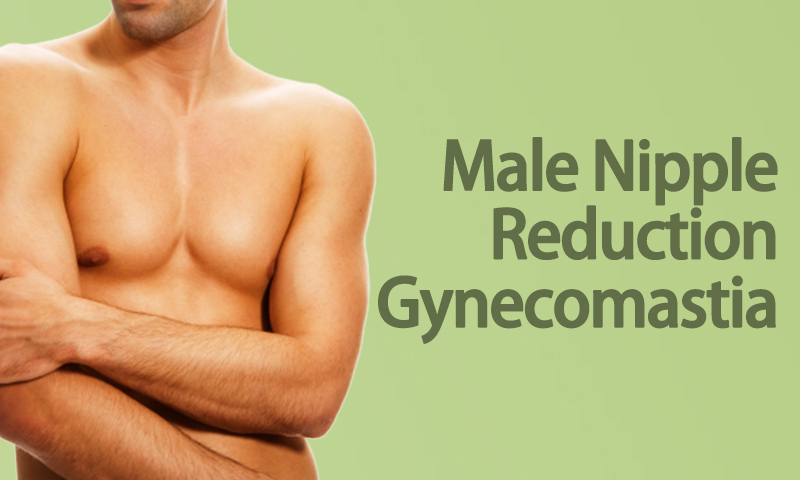 Male Nipple Reduction Gynecomastia
