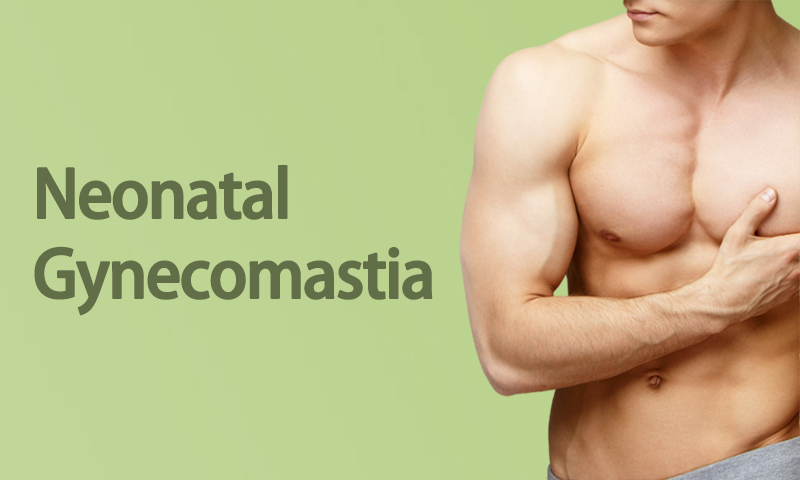 Neonatal Gynecomastia