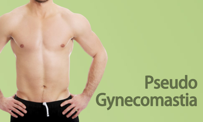 Pseudo Gynecomastia
