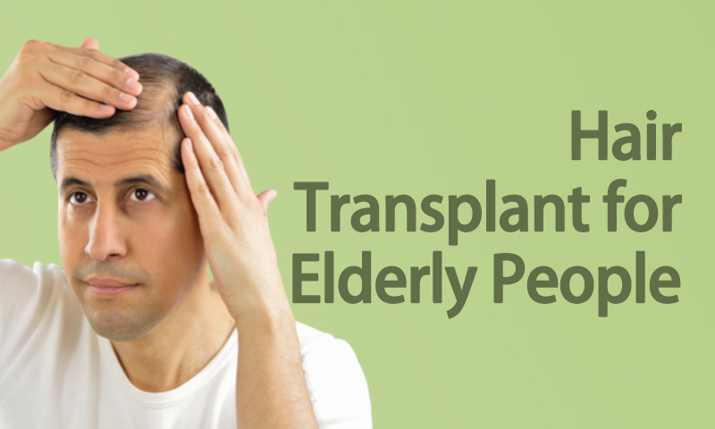 Hair Transplant For Elderly People