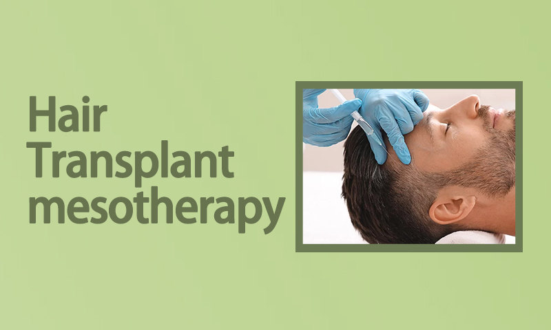 Hair Transplant Mesotherapy